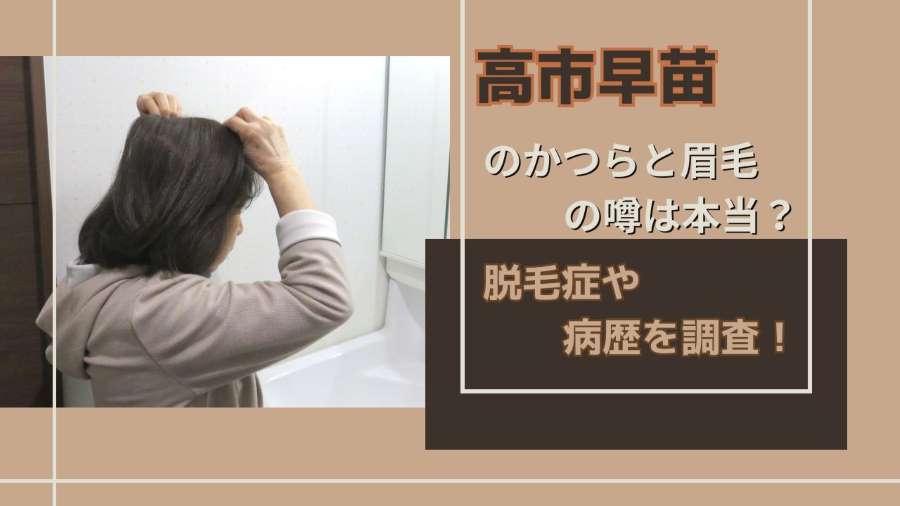 高市早苗のかつらと眉毛の噂は本当?脱毛症や病歴を調査!